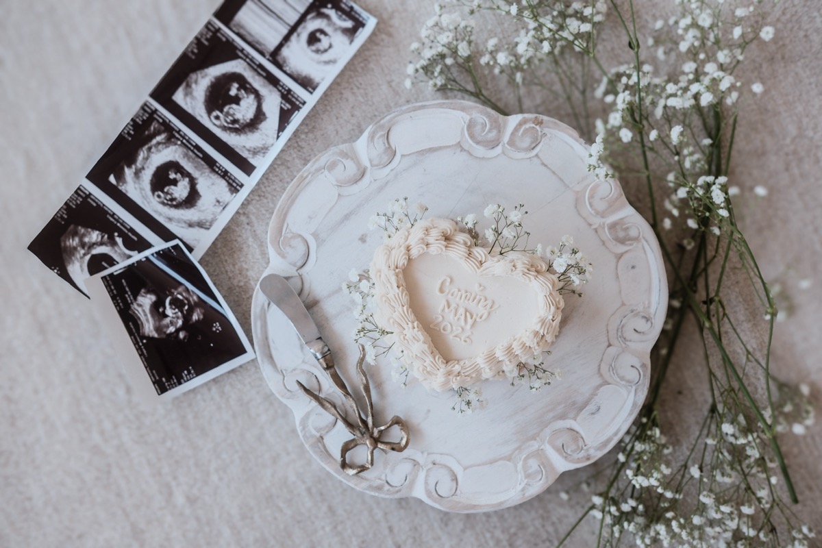 Flat-lay with cake and ultrasound
